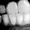 Think you know everything about Bruxism? Think Again!